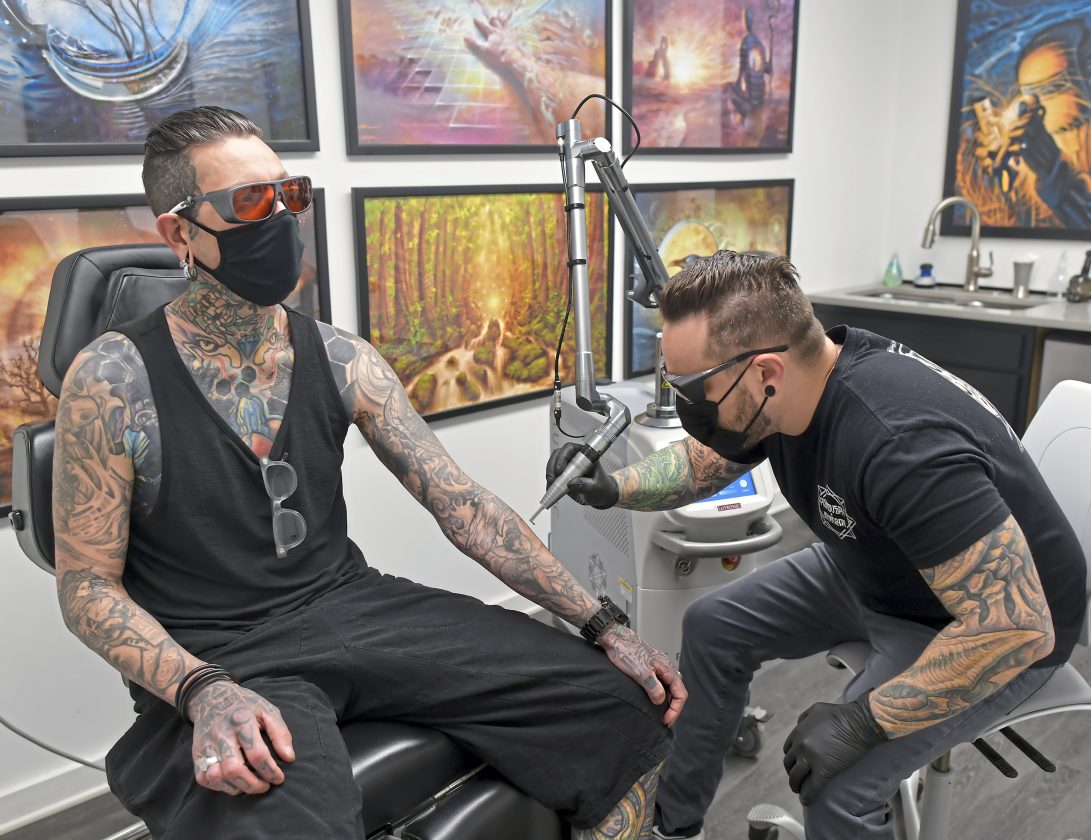 Tattoo removal booming as people pay to make old ink go away News